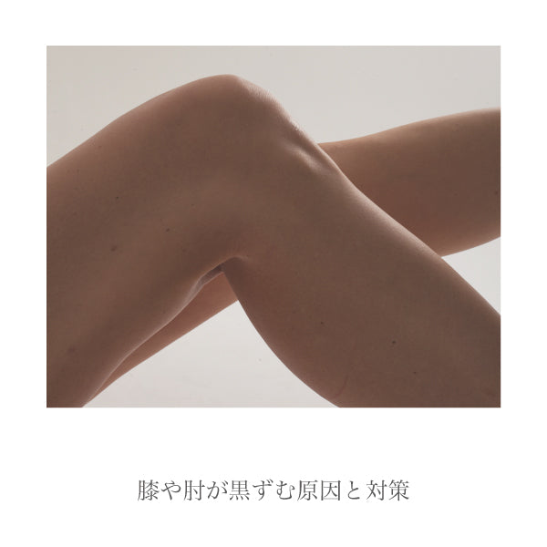 肌見せしたい方へ膝や肘の黒ずみの原因と対策を紹介